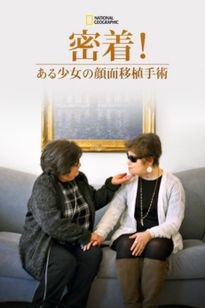 密着！ある少女の顔面移植手術