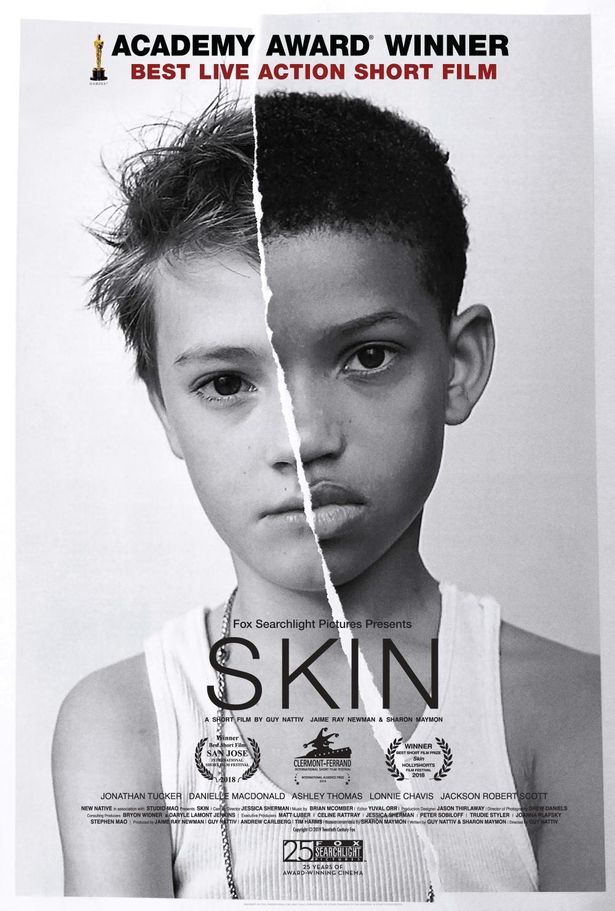 短編映画『SKIN』は、はガイ・ナティーヴ監督が、長編映画の出資を募るために全額自己資金で製作した