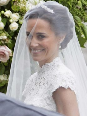 挙式のために歯列矯正＆ホワイトニングしたというピッパ・ミドルトン