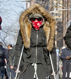 骨を打撲し、松葉杖をついて生活中のマドンナ