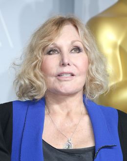 ボトックスが不自然？名女優のキム・ノヴァク