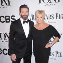 『ピーターパン』で黒ひげを演じるため、ヒューがスキンヘッドに！